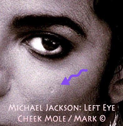 TWIN EYE: Michael Jackson Natural LEFT EYE Cheek Mole in light round Form ©